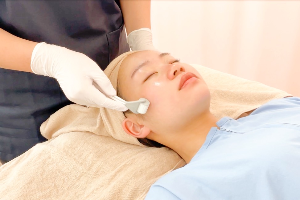 Dermaroller Japanが扱う美容鍼とは異なる肌再生鍼「ダーマローラー」を受けている女性の写真（別パターン）